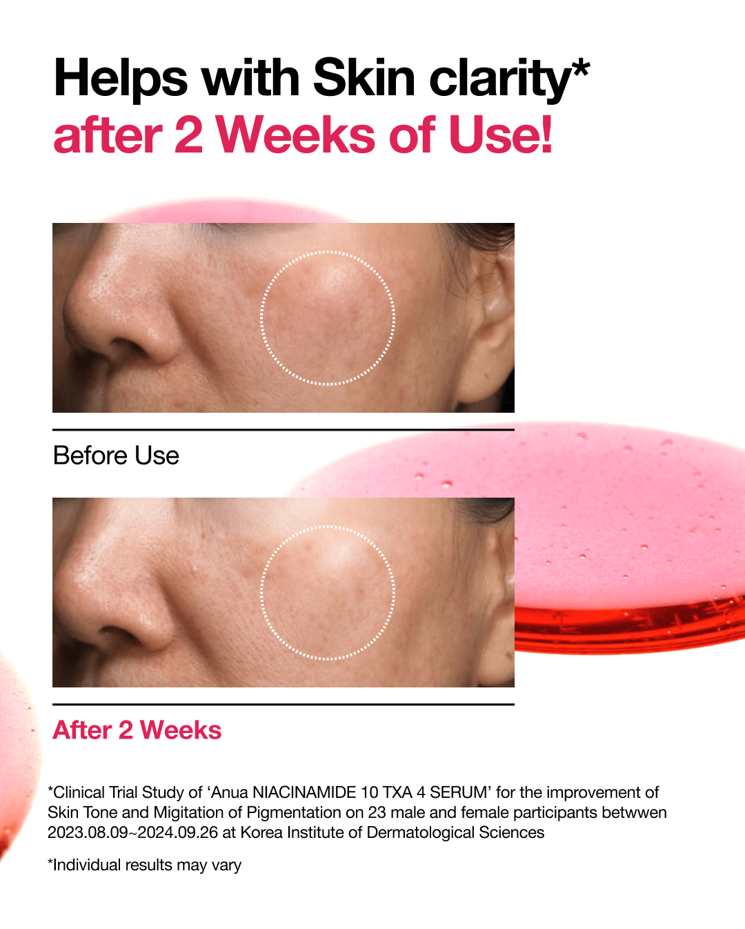 Sérum NIACINAMIDE 10% + TXA 4%